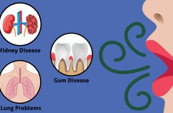 What Your Breath Smell Can Tell You About Your Health