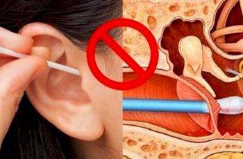 Cotton Swabs Are Most Commonly Used For Cleaning Ears, But After Seeing This You Might Think Twice