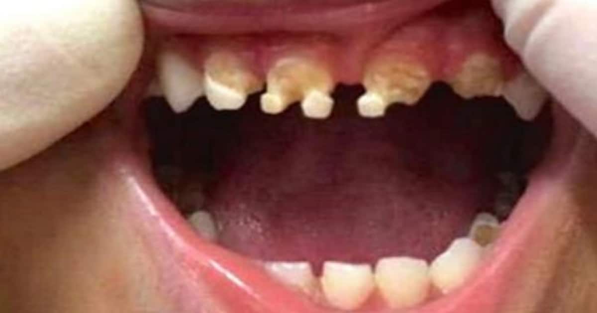 the-dentist-opens-a-3-year-old-mouth-and-asks-the-mother-if-she-ever